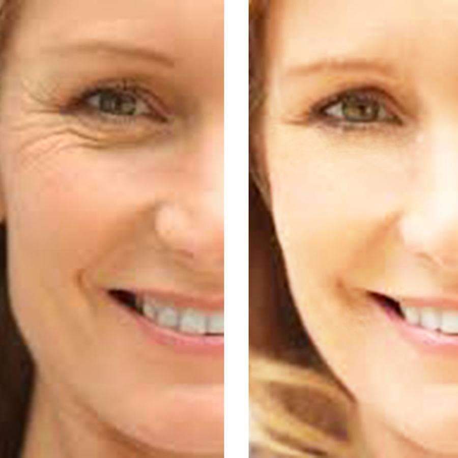 Age Defense : Eye Wrinkle Cream + Vitamin C Serum - Adrasse Cosmetics