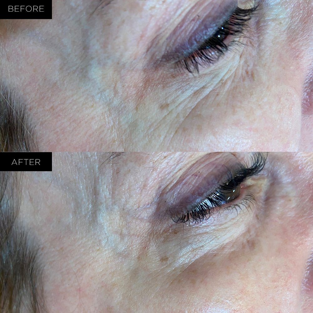Endure™ Beauty Organic Hydrating Under Eye Therapy Gel Pads - Adrasse Cosmetics